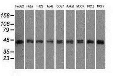 Western Blot: DAP Kinase 2 Antibody (OTI1C5)Azide and BSA Free [NBP2-71753]