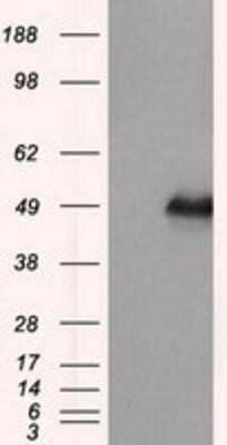 Western Blot: DAP Kinase 2 Antibody (OTI1C5)Azide and BSA Free [NBP2-71753]