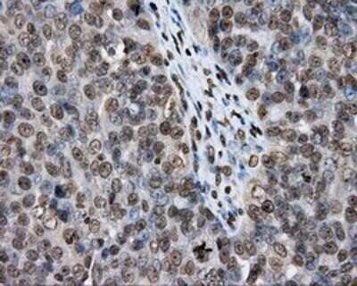 Immunohistochemistry-Paraffin: DAP Kinase 2 Antibody (OTI1C5) [NBP2-02477]