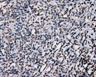 Immunohistochemistry-Paraffin: DAP Kinase 2 Antibody (OTI1C5) [NBP2-02477]