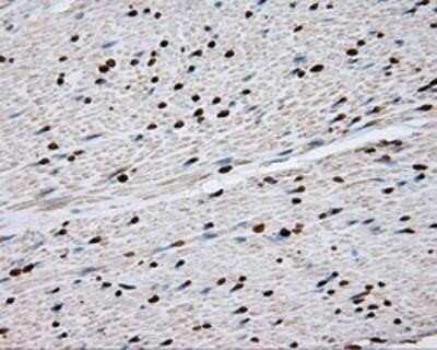 Immunohistochemistry-Paraffin: DAP Kinase 2 Antibody (OTI1C5) [NBP2-02477]