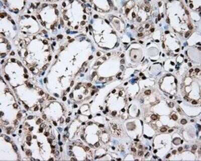 Immunohistochemistry-Paraffin: DAP Kinase 2 Antibody (OTI1C5) [NBP2-02477]