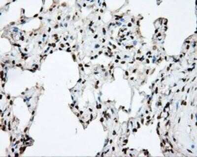 Immunohistochemistry-Paraffin: DAP Kinase 2 Antibody (OTI1C5) [NBP2-02477]