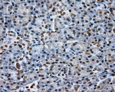 Immunohistochemistry-Paraffin: DAP Kinase 2 Antibody (OTI1C5) [NBP2-02477]