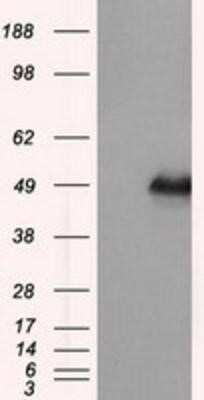 Western Blot: DAP Kinase 2 Antibody (OTI1C5) [NBP2-02477]