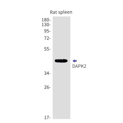 Western Blot: DAP Kinase 2 Antibody (S09-8F2) [NBP3-19618]