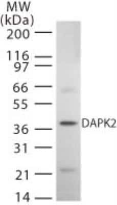 Western Blot: DAP Kinase 2 Antibody [NB100-56344]