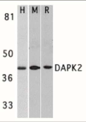 Western Blot: DAP Kinase 2 AntibodyBSA Free [NBP1-77291]