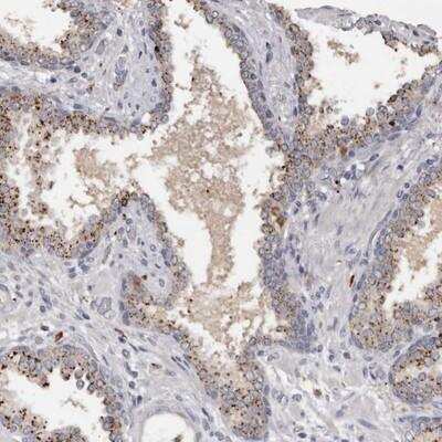 Immunohistochemistry-Paraffin: DAP1 Antibody [NBP1-91031]