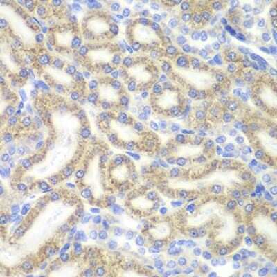 Immunohistochemistry-Paraffin: DAP1 Antibody - BSA Free [NBP2-92897]