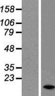 Western Blot: DAP1 Overexpression Lysate [NBP2-10587]