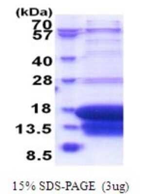 SDS-PAGE: Recombinant Human DAP1 His Protein [NBP2-51791]