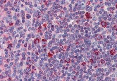 Immunohistochemistry-Paraffin: DAP12 Antibody [NBP1-52376]