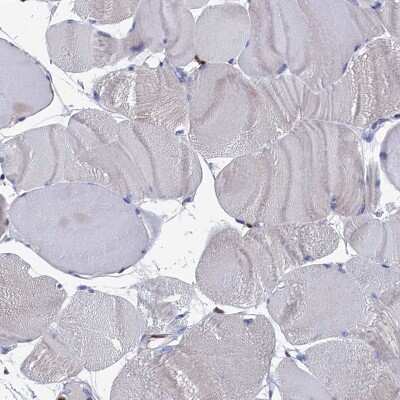 Immunohistochemistry-Paraffin: DAP12 Antibody [NBP1-85313]