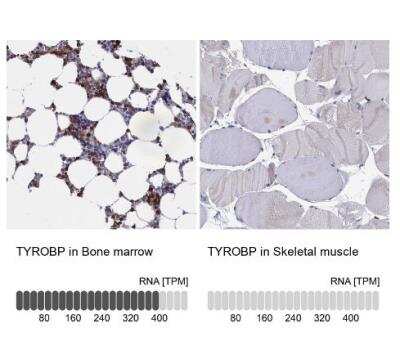 Immunohistochemistry-Paraffin: DAP12 Antibody [NBP1-85313]