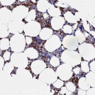 Immunohistochemistry-Paraffin: DAP12 Antibody [NBP1-85313]