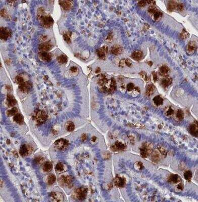 Immunohistochemistry-Paraffin: DAP12 Antibody [NBP1-85313]