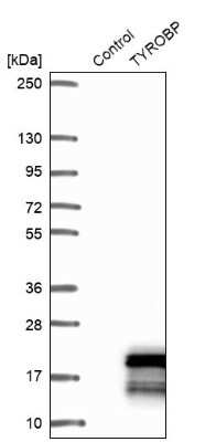 Western Blot: DAP12 Antibody [NBP1-85313]