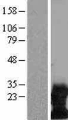 Western Blot: DAP12 Overexpression Lysate [NBL1-17483]