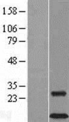 Western Blot: DAP12 Overexpression Lysate [NBL1-17484]