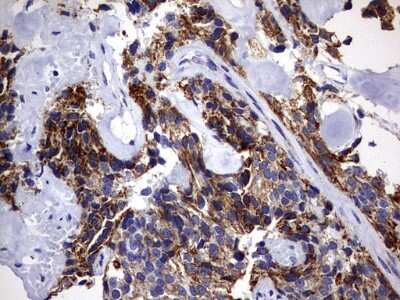 Immunohistochemistry: DAP3 Antibody (OTI1B12) [NBP2-46427]