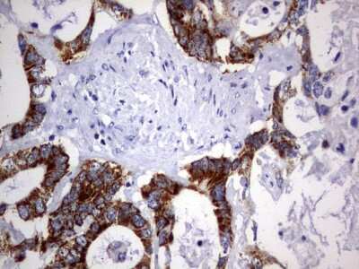 Immunohistochemistry: DAP3 Antibody (OTI1B12) [NBP2-46427]