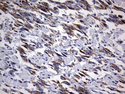 Immunohistochemistry: DAP3 Antibody (OTI1B12) [NBP2-46427]