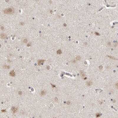 Immunohistochemistry-Paraffin: DAP3 Antibody [NBP1-88568]