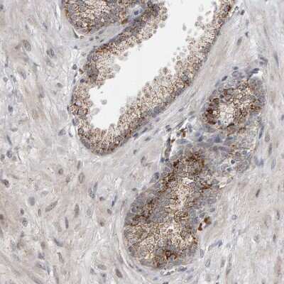 Immunohistochemistry-Paraffin: DAP3 Antibody [NBP1-88568]