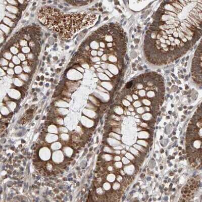 Immunohistochemistry-Paraffin: DAP3 Antibody [NBP1-88568]