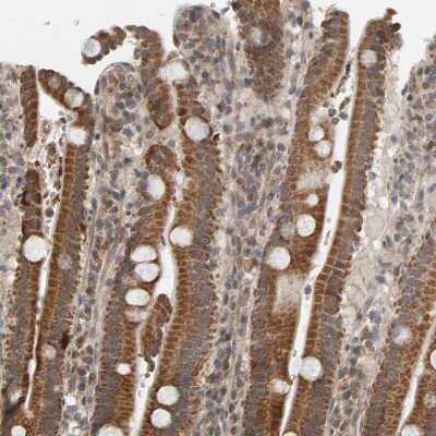 Immunohistochemistry-Paraffin: DAP3 Antibody [NBP1-88568]
