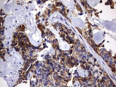 Immunohistochemistry: DAP3 Antibody (OTI1B12) - Azide and BSA Free [NBP2-71338]