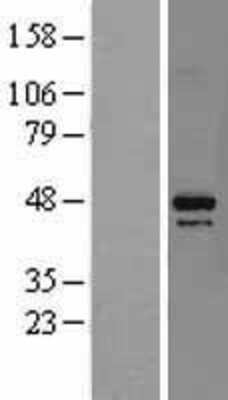 Western Blot: DAP3 Overexpression Lysate [NBL1-09715]