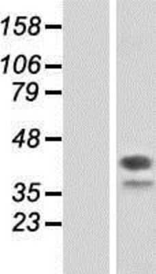 Western Blot: DAP3 Overexpression Lysate [NBP2-09807]