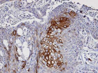 Immunohistochemistry-Paraffin: DAP5 Antibody [NBP1-31469]