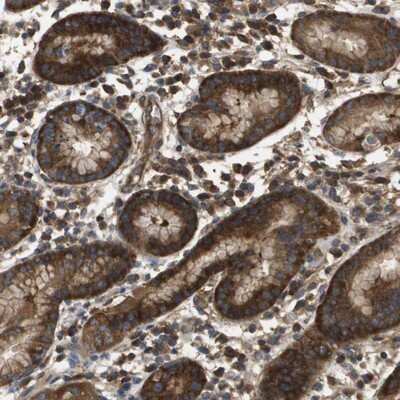 Immunohistochemistry-Paraffin: DAP5 Antibody [NBP1-85310]