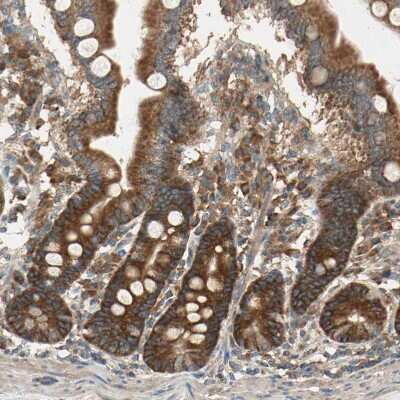 Immunohistochemistry-Paraffin: DAP5 Antibody [NBP1-85311]