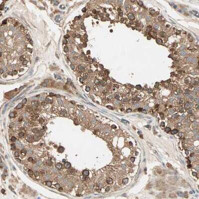 Immunohistochemistry-Paraffin: DAP5 Antibody [NBP1-85311]