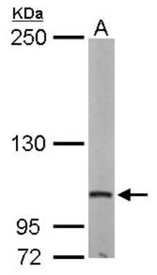 Western Blot: DAP5 Antibody [NBP1-31469]