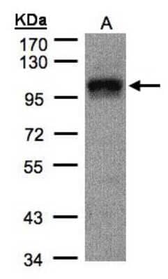 Western Blot: DAP5 Antibody [NBP1-31469]