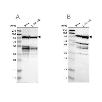 Western Blot: DAP5 Antibody [NBP1-85310]