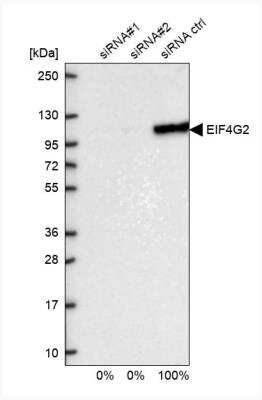 Western Blot: DAP5 Antibody [NBP1-85311]