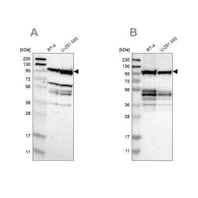 Western Blot: DAP5 Antibody [NBP1-85311]