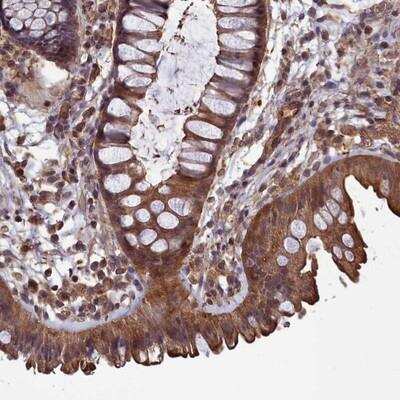 Immunohistochemistry: DAPK3/ZIPK Antibody [NBP1-86832]
