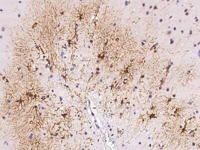 Immunohistochemistry-Paraffin: DAPK3/ZIPK Antibody [NBP2-98766]