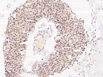 Immunohistochemistry-Paraffin: DAPK3/ZIPK Antibody [NBP2-98766]