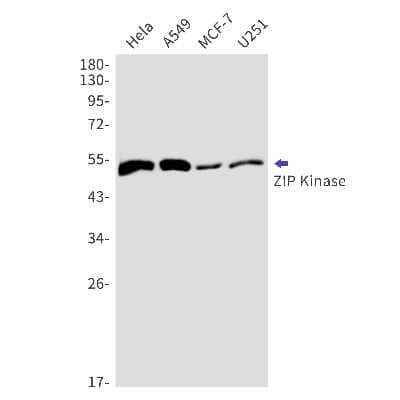 Western Blot: DAPK3/ZIPK Antibody (S02-7F5) [NBP3-15020]