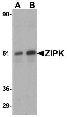 Western Blot: DAPK3/ZIPK AntibodyBSA Free [NBP1-76962]