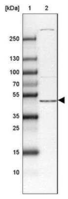 Western Blot: DAPK3/ZIPK Antibody [NBP1-86832]