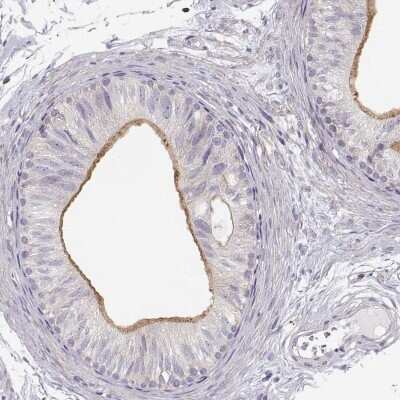 Immunohistochemistry-Paraffin: DAPL1 Antibody [NBP2-14582]